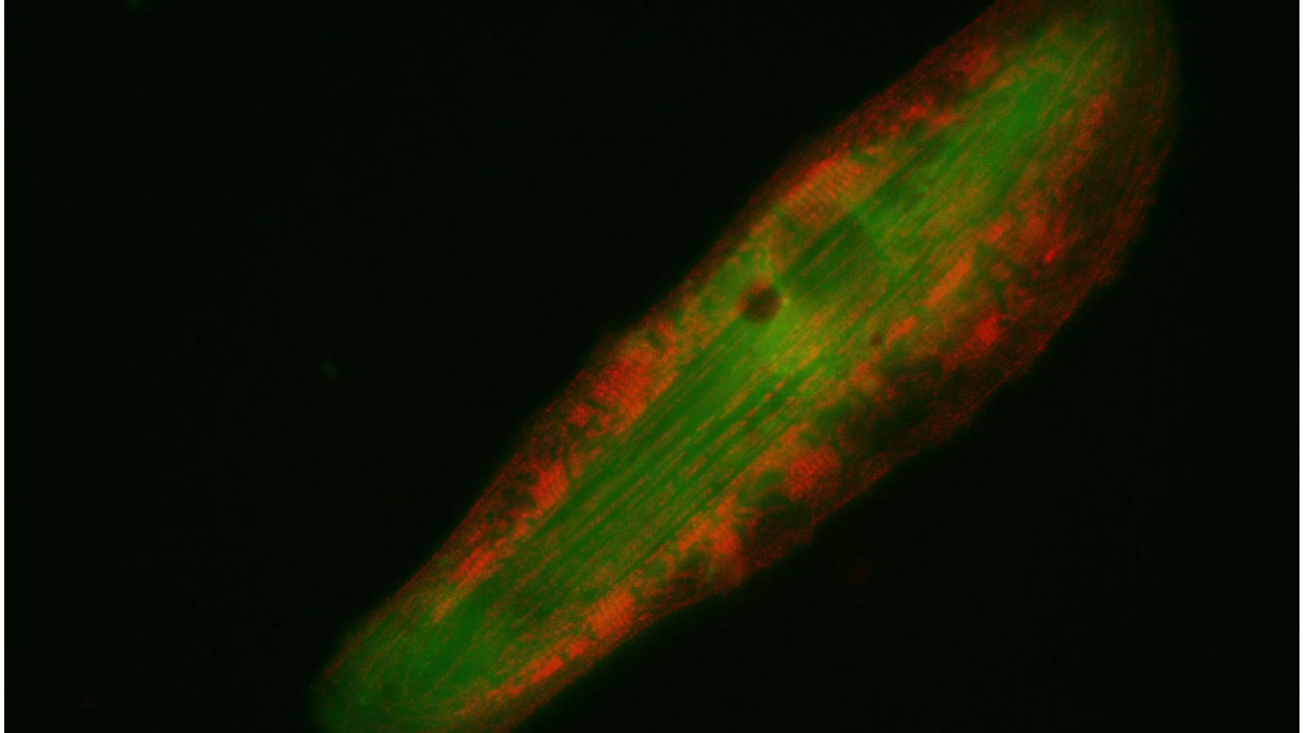 Actin and Calcium inside a human stem cell-derived cardiac muscle cell